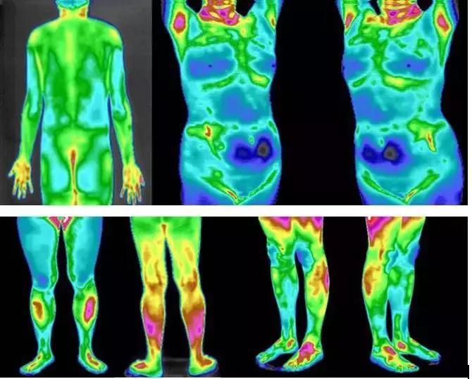 这个仪器好神奇：红黄蓝绿，扫描后身体病症成像仿佛是气象云图