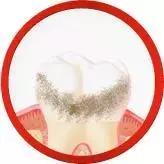 牙刷选得好牙医看得少｜2018年电动牙刷比较试验