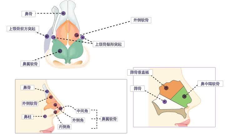 不动手术有哪些隆鼻方法,不动刀的隆鼻好方法