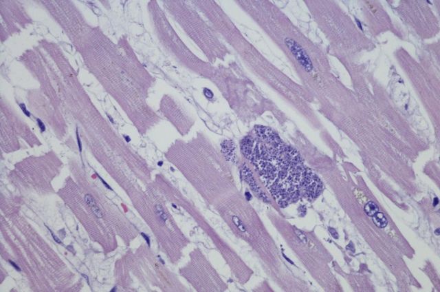 人感染了弓形虫病有什么反应,弓形虫病如何有效预防