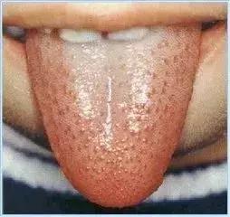 舌头出现这四种情况需要注意,舌头这3种表现多半是身体在报警