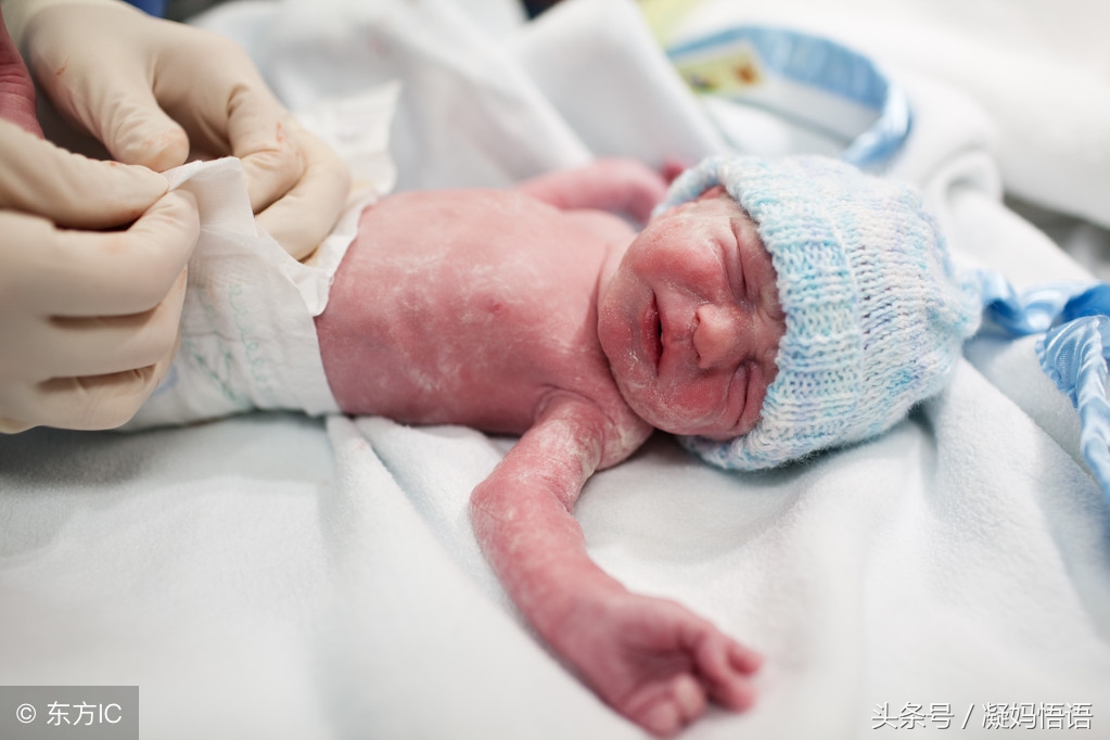 剖腹产是自己选择横切还是竖切,剖腹产可以自己选择时间剖么