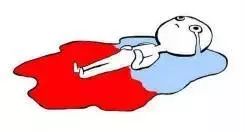 日本妇科病,日本女人妇科病少的原因