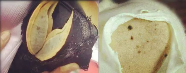 日本妇科病,日本女人妇科病少的原因