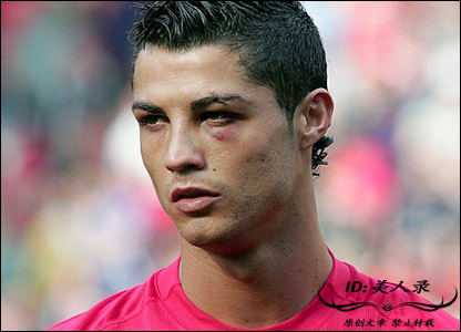 c罗受过最重的伤视频,c罗那些年欧冠