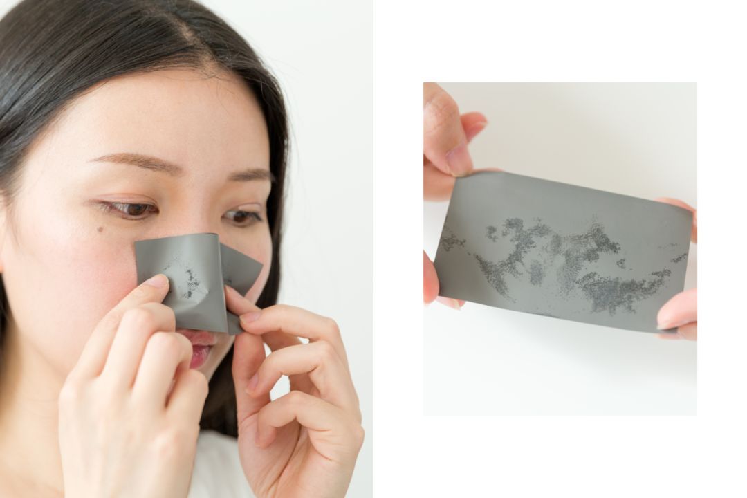 28天解决了所有皮肤问题，你猜我做了些什么？