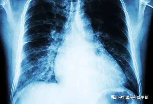 高血压停药的危害,高血压的危害视频