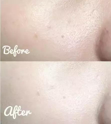 如何选择适合皮肤的粉底液,什么粉底适合中性肤质