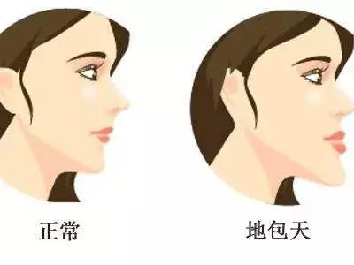 暑期孩子想矫正牙齿？北京口腔医院专家来解答这10个问题