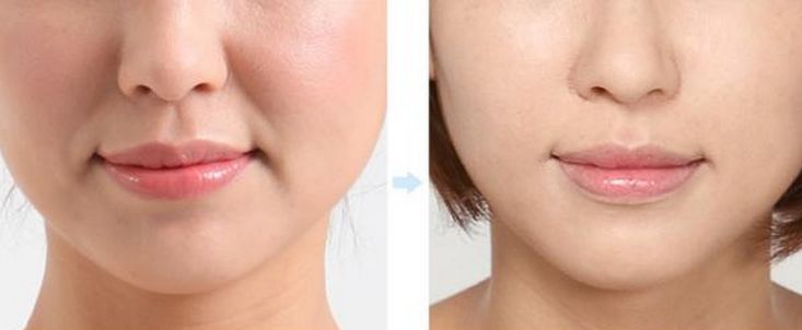 韩国牌子眼霜抗老去皱保湿,平价好用的韩国化妆品牌