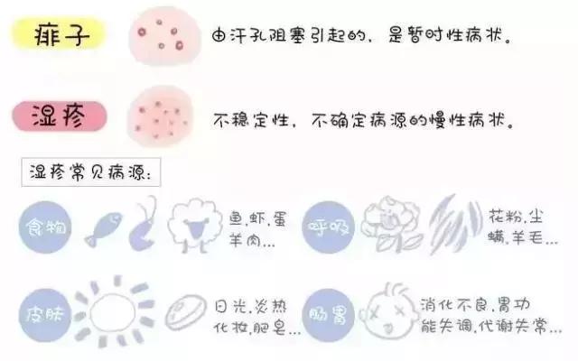 宝宝湿疹和痱子可不一样,这个方法学会了,对付湿疹最好了!