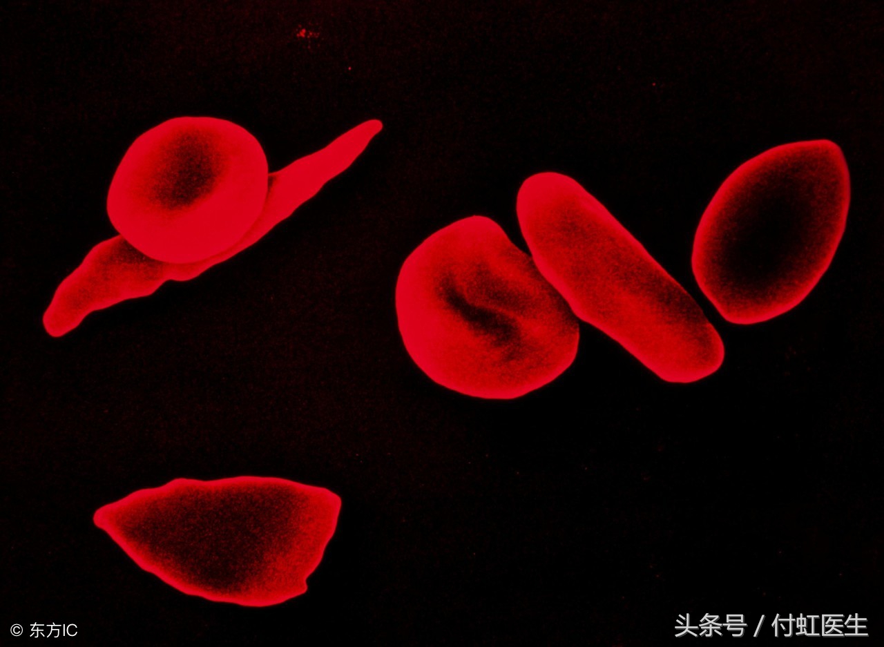 月经正常为何医生诊断月经不调,内膜增生息肉是什么原因引起呢