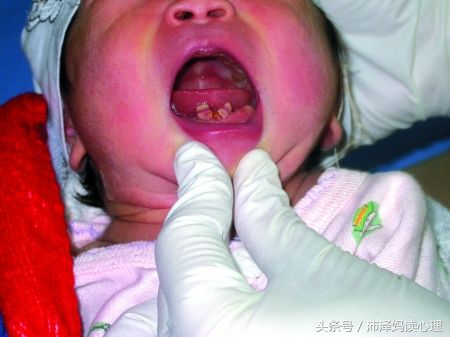 新生儿女孩来月经,新生女宝宝春季