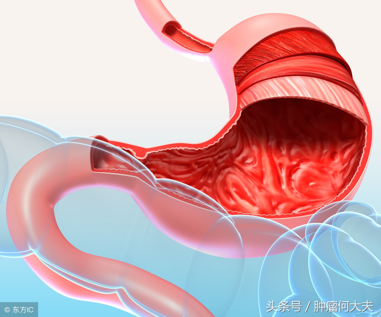 孕21周呕吐有可能是胃癌吗,怀孕21周突然头晕想吐是怎么回事