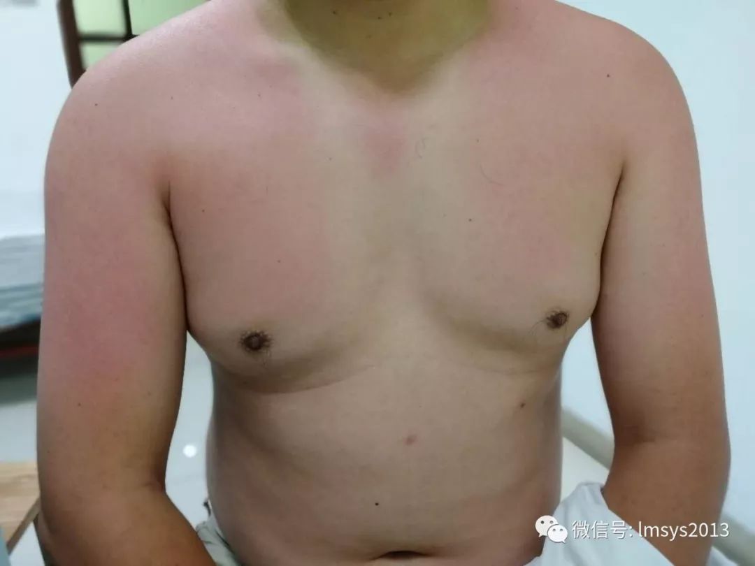 夏日旅游防晒必备推荐,暑假旅游防晒必备物品有哪些