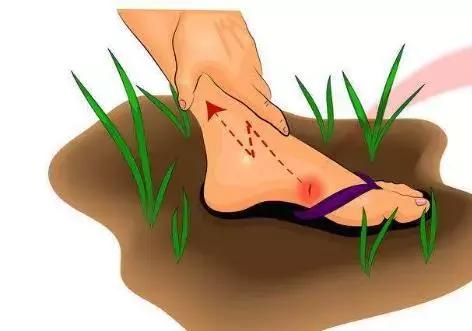 多大的伤口才能导致破伤风感染,伤口在哪种情况下容易感染破伤风