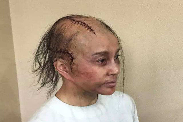 挑战全网最强光头,光头颜值挑战第一