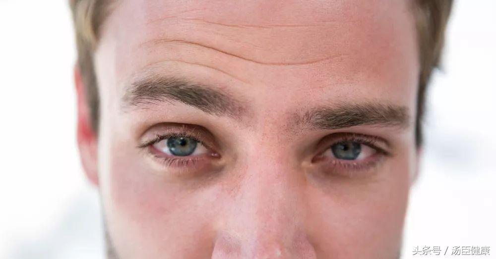 什么样的眉毛是杂乱眉,眉毛非常稀疏适合雾眉还是线条眉