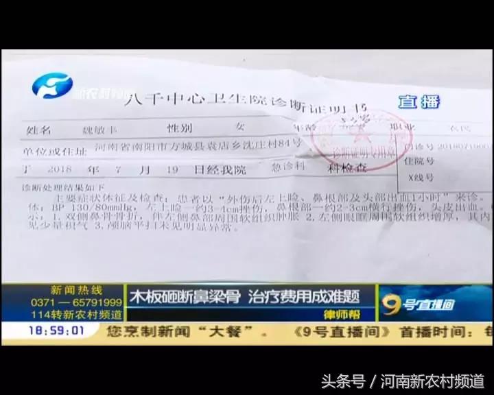 鼻骨被砸断,把我的鼻梁骨砸断怎么办