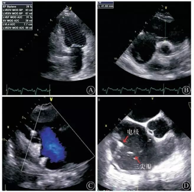 协和医院疑难杂症案例,协和医院疑难杂症视频