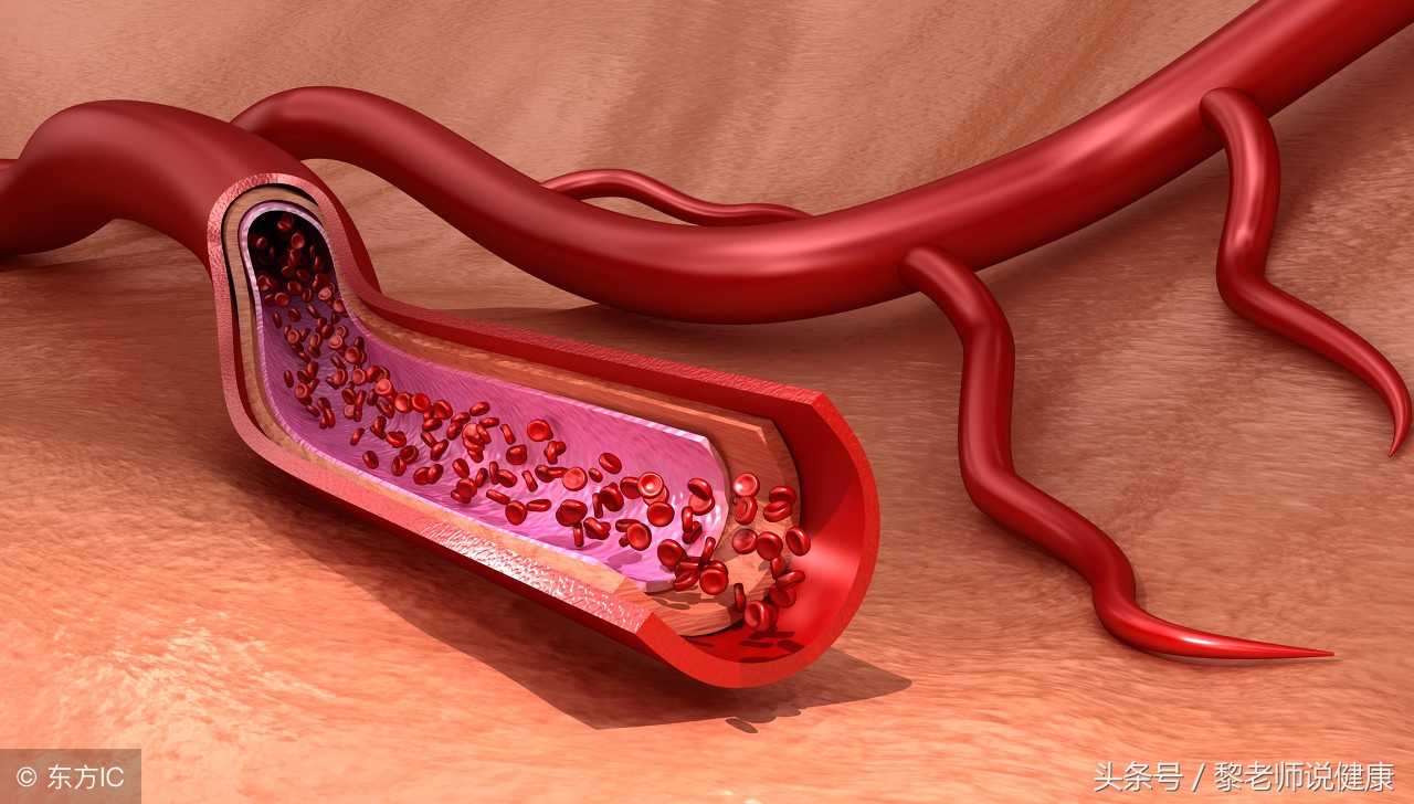 身体莫名其妙出现紫色淤青,身体突然有淤青是白血病
