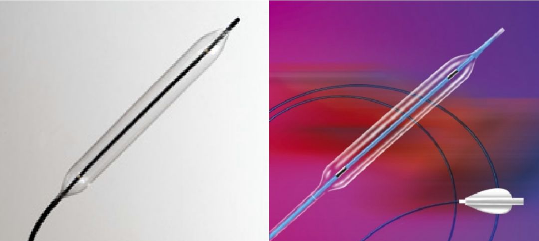 糖尿病下肢血管介入手术成功率,糖尿病下肢麻木中医辨证分析