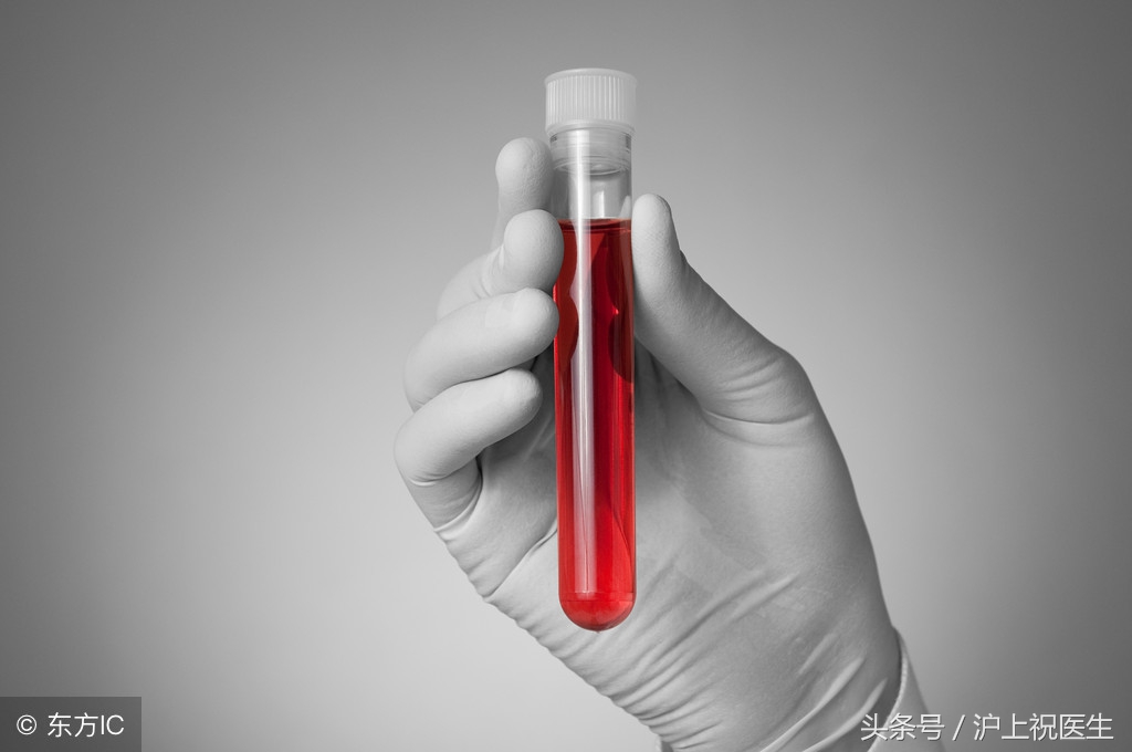 为什么体检抽了六管血,抽出来的血是黑色的