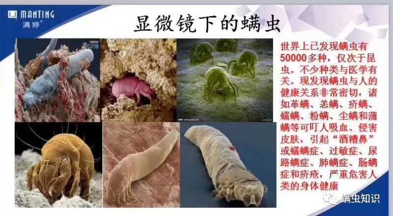 换季脸上长痘,换季脸上长痘痒怎么办