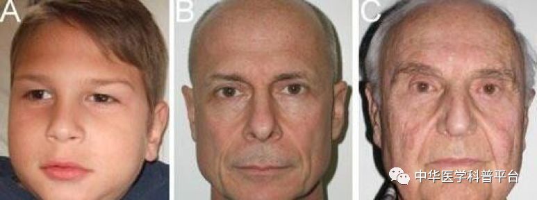 整形课,整形为什么越来越难看