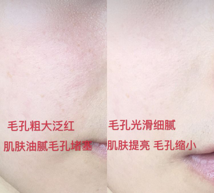 luna洁面仪日版和韩版哪个好,亲测好用四款洁面