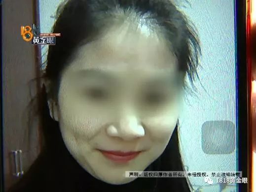 杭州点痣女生,去医院取痣花了1000多元