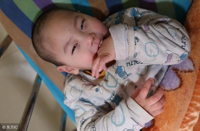 小儿脑瘫应该如何治,小儿脑瘫康复治疗的最佳时期