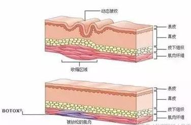 整形医生揭露行业黑幕,注射玻尿酸的八大谣言别再相信了