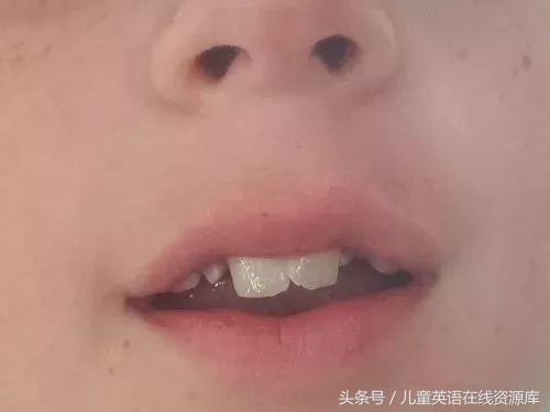 孩子总是反写字母,b和d不分,p和q不分,怎么破?