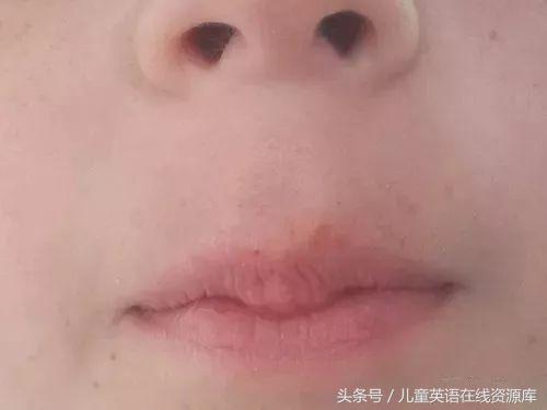 孩子总是反写字母,b和d不分,p和q不分,怎么破?