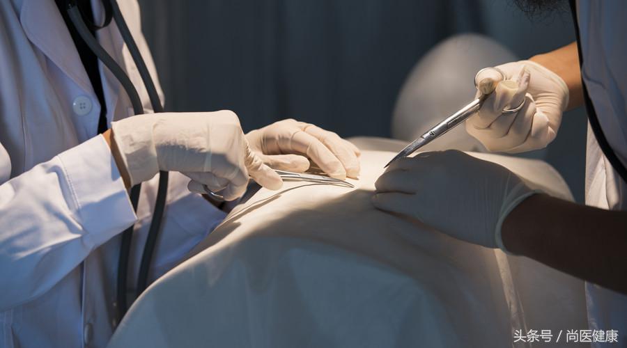 肝硬化脾脏切除手术大概多少钱,肝硬化脾脏切除手术后能干活吗