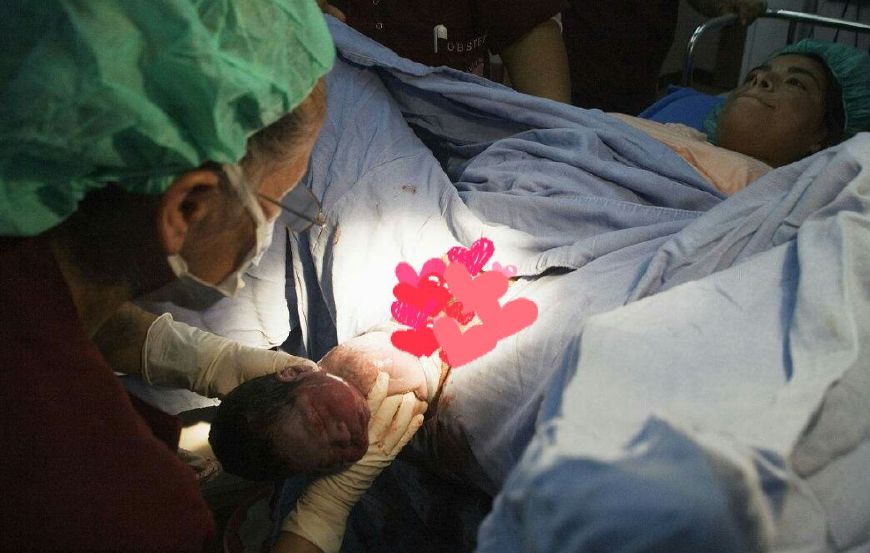 生完小孩后很轻松,生完孩子身体轻松