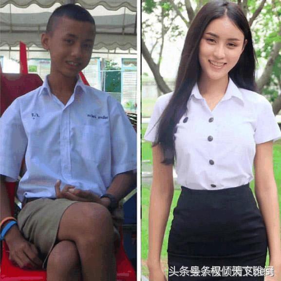 泰国人变性术前后对比,泰国的变性手术是什么原理