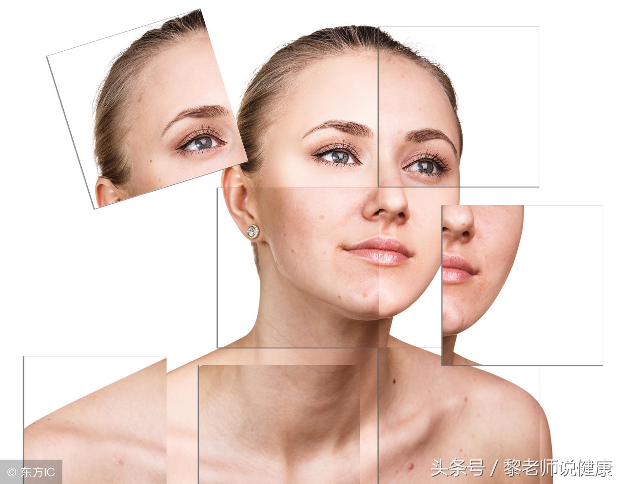 怎么治疗白癜风才能防止白斑复发,吃什么可以改善预防白癜风