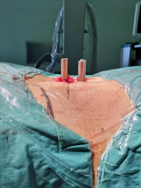 安阳市安钢总医院骨科专家,安钢医院脊柱微创中心主任名单