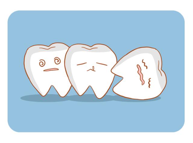 科普牙齿健康知识,牙齿不疼也需要治疗吗