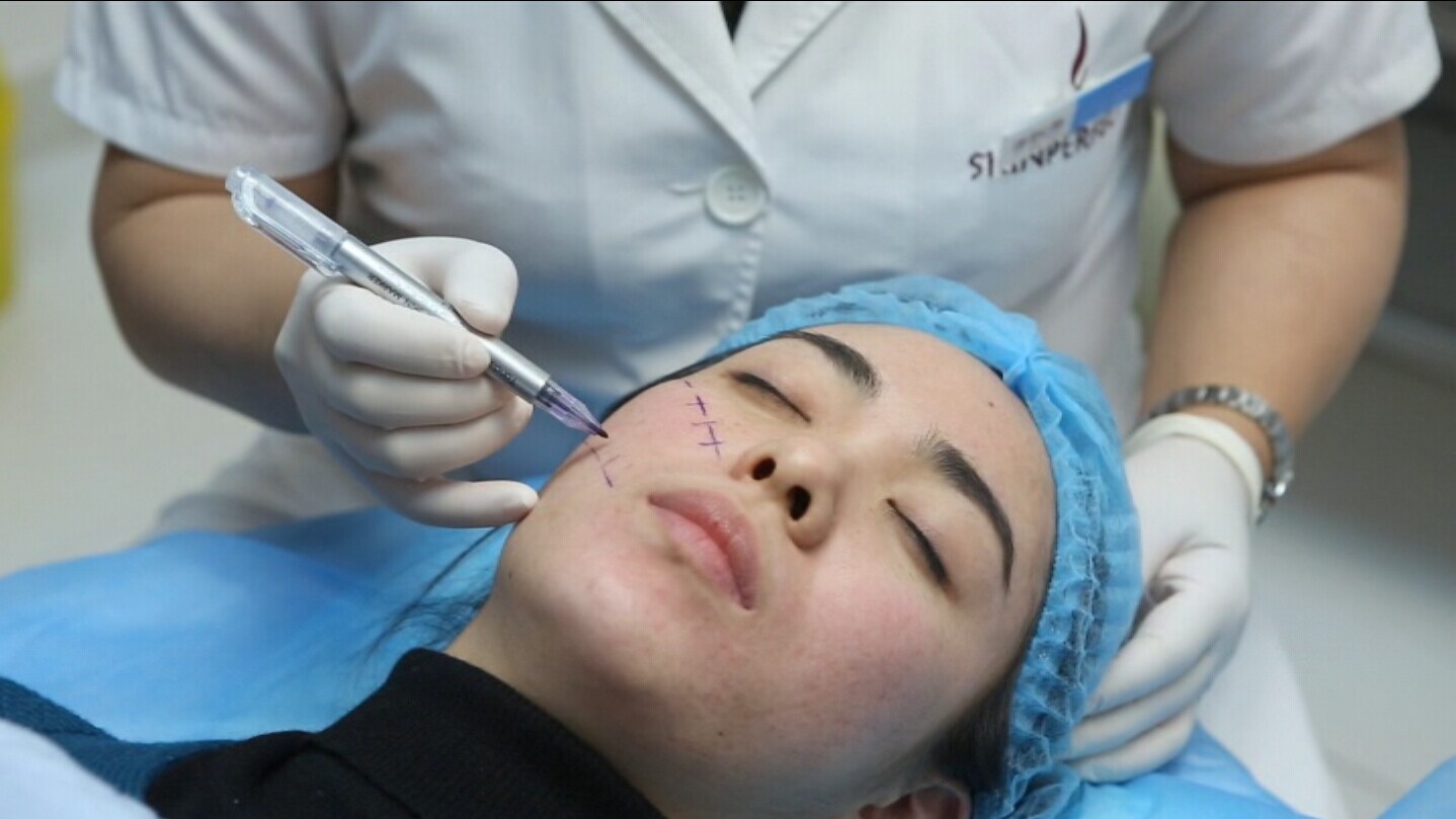 有法令纹很显老怎么办,法令纹木偶纹哪个显老