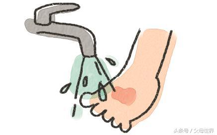 孩子烫伤第一时间怎么处理,孩子烫伤恢复过程