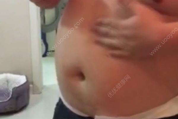 科学减肥方法和技巧,科学减肥方法多