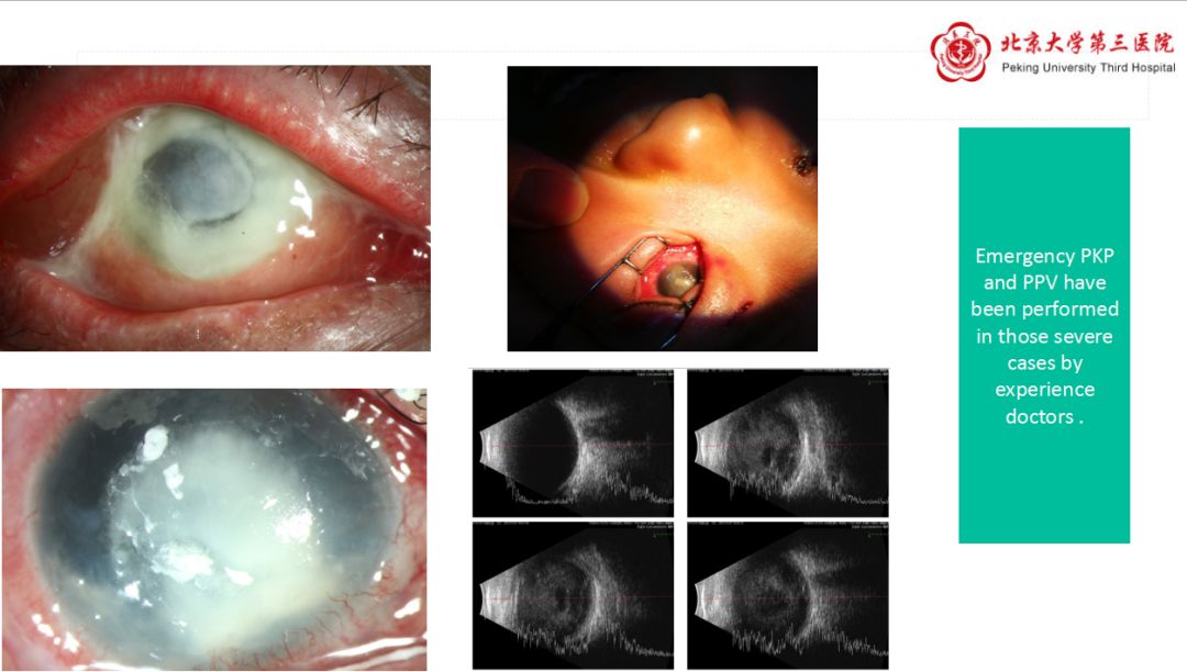 与时间赛跑同病魔较量演讲,与时间赛跑急救医生
