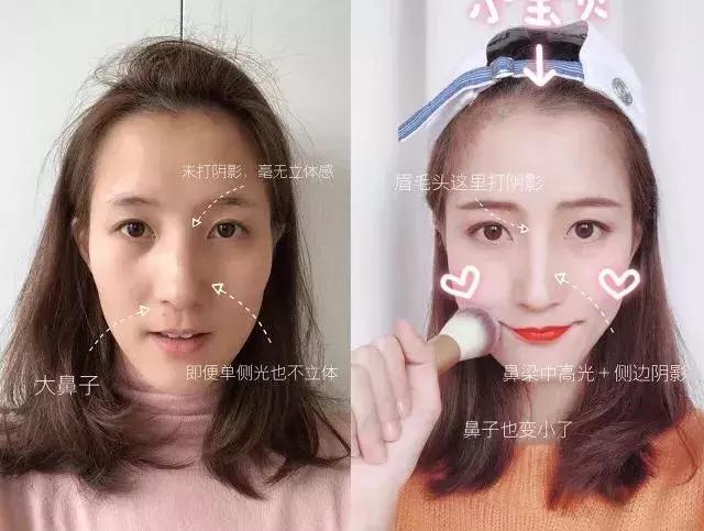 张韶涵护肤美容,张韶涵面部填充