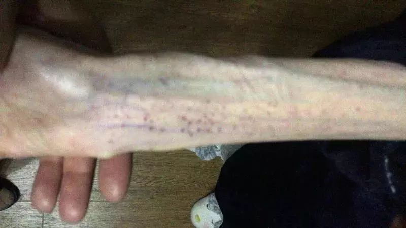 29岁女子自杀式减肥 (21岁女子自杀式减肥)