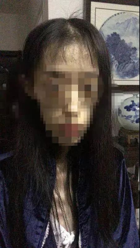 「微提醒」“自杀式”减肥要不得！21岁女孩体重竟然只有50斤！