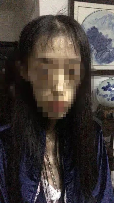 1米67才50斤!21岁女孩“自杀式减肥”,哈医大好几个科医生联手才把她救过来……