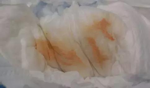 出生没几天的女婴尿布上有血，妈妈惊了！姥姥却很淡定